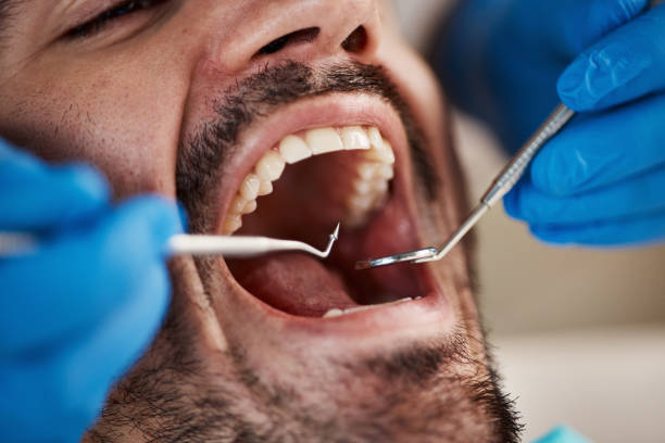 Best Pediatric Emergency Dentist in Ferndale, MD