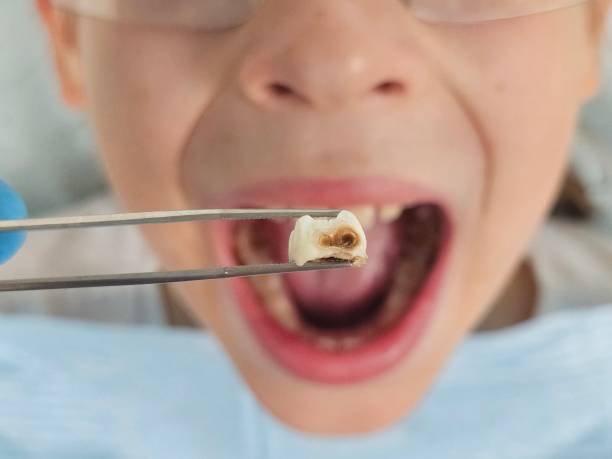 Best Holiday Emergency Dentist in Ferndale, MD